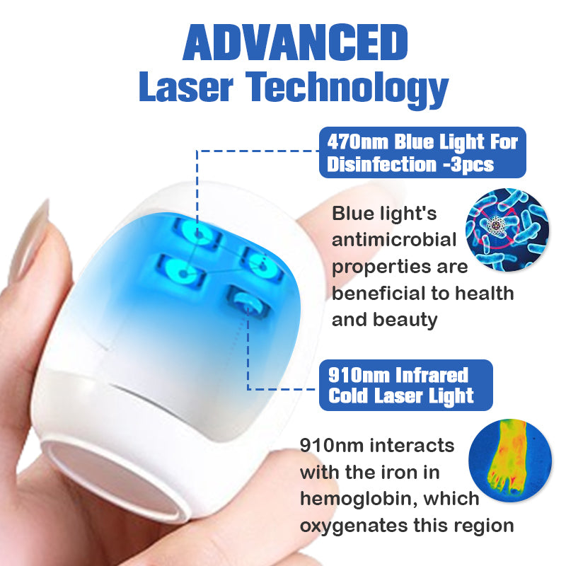 000Furzero™ Hřebíky Fungus Čisticí laser Zařízení pro úlevu